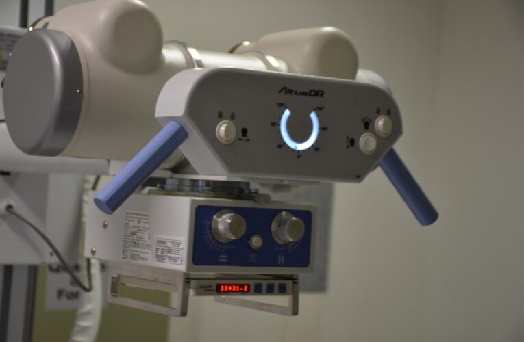 Pronto Socorro Adulto de Botucatu tem novo equipamento de Raio-X