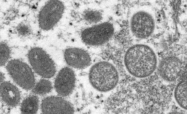 OMS confirma 132 casos de varíola dos macacos e diz que surto “pode ser contido”