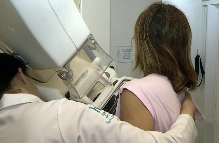 Botucatu terá carreta para exames de mamografia na próxima semana