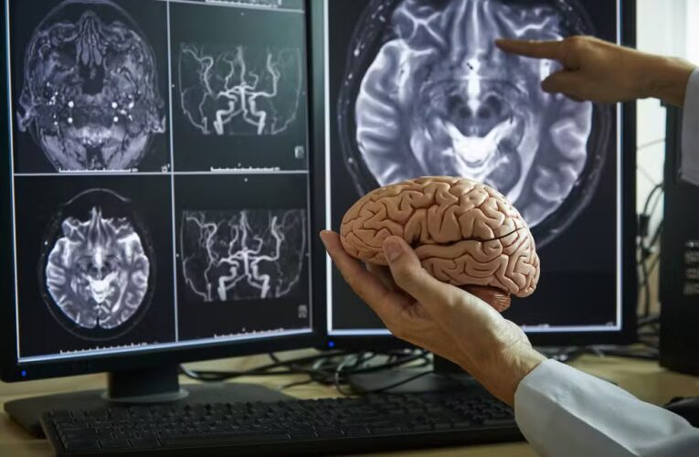 OMS pede atenção urgente à saúde cerebral